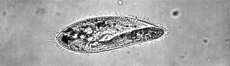  Chileridium! A Tiny Swimmer Hiding Within Its Ciliated Armor