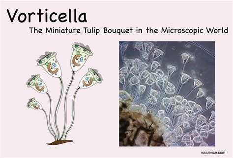  Vorticella! A Tiny Tornado Swirling with Microscopic Elegance and Unseen Tentacular Feasting